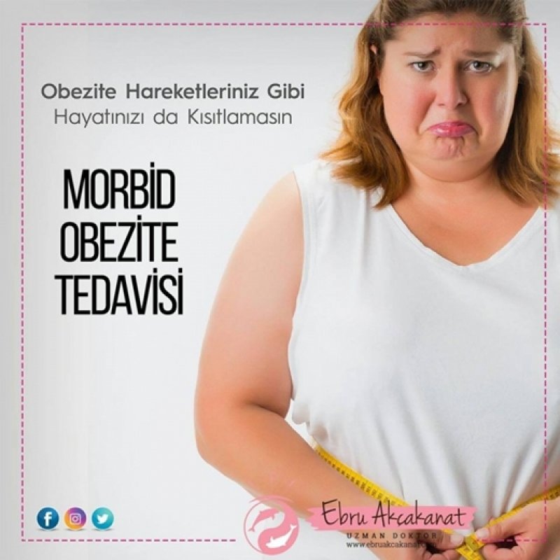 Morbid Obezite Tedavisi